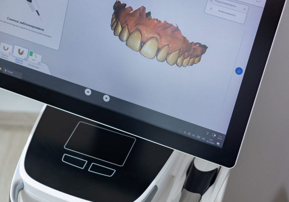 clinica-dental-el-brillante-despacho-del-dentista (1)