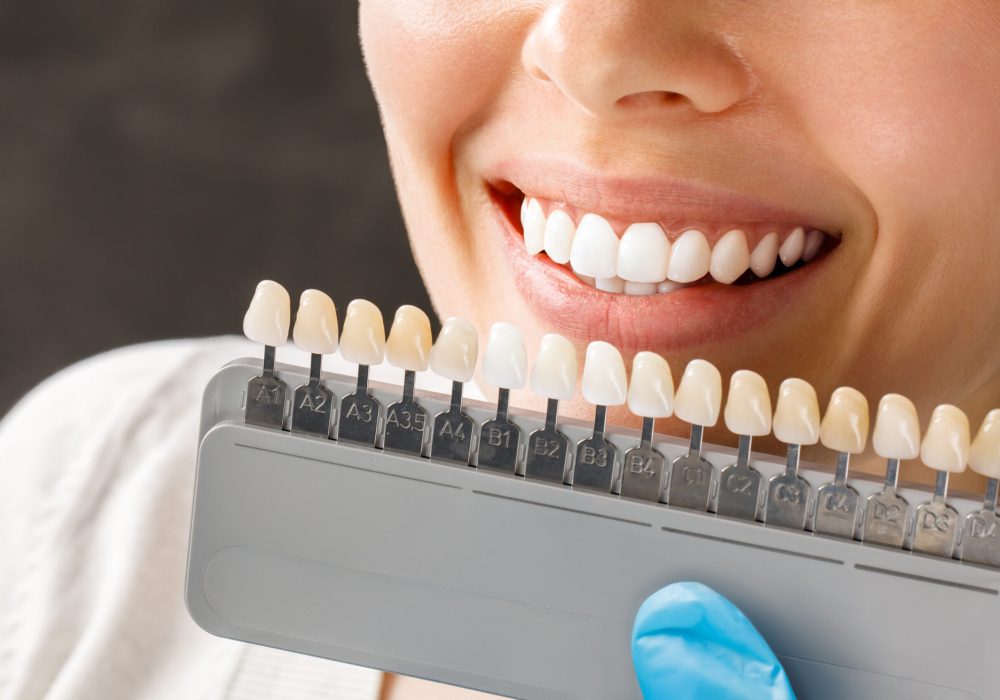 Smiling young woman. Cosmetological teeth whitening in a dental clinic. selection of the tone of the implant tooth.